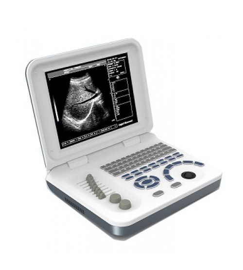 Ultrasound Machine Note Book Daignistic Scanner Ecomed EUS-6 China