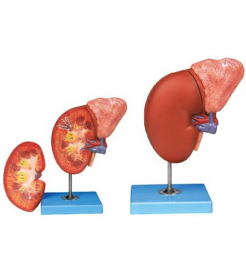 Human Kidney With Ardenal Gland
