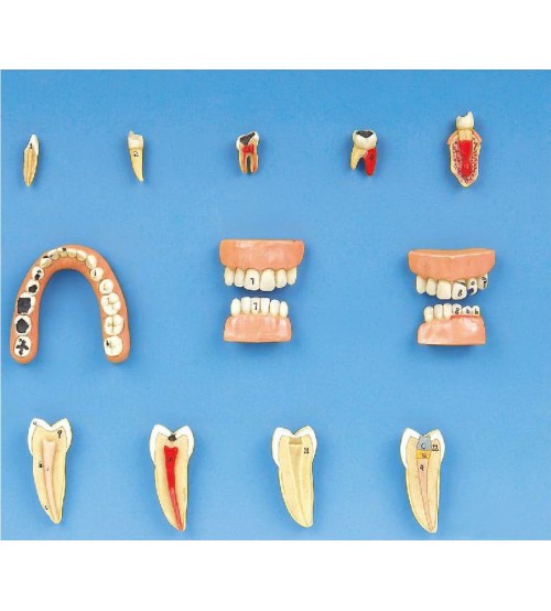 Dental Diseases Model