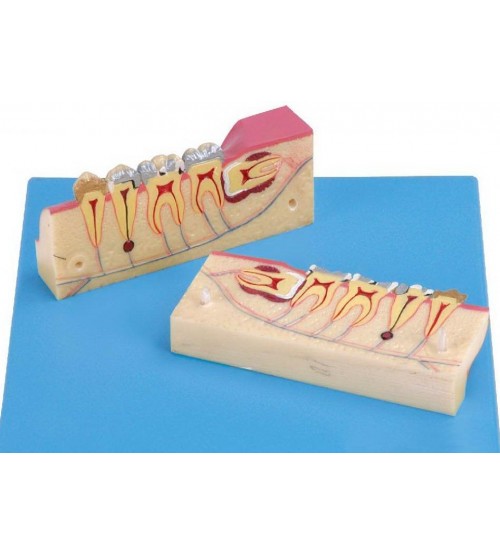 Dissected Model Of Teeth Tissue